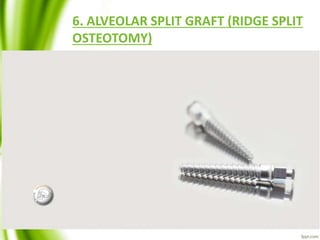 6. ALVEOLAR SPLIT GRAFT (RIDGE SPLIT
OSTEOTOMY)
 