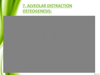 7. ALVEOLAR DISTRACTION
OSTEOGENESIS:
 