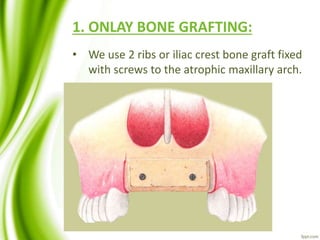 1. ONLAY BONE GRAFTING:
• We use 2 ribs or iliac crest bone graft fixed
with screws to the atrophic maxillary arch.
 