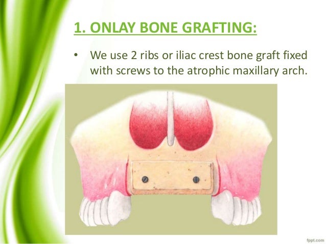 vestibuloplasty indications pre prosthetic surgery vestibuloplasty indications pre prosthetic surgery