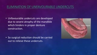 ELIMINATION OF UNFAVOURABLE UNDERCUTS
• Unfavourable undercuts are developed
due to severe atrophy of the mandible
which hinders in proper denture
construction.
• So surgical reduction should be carried
out to relieve these undercuts.
 