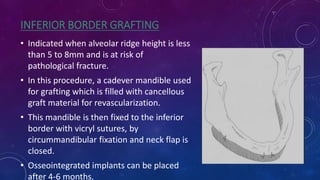 • Indicated when alveolar ridge height is less
than 5 to 8mm and is at risk of
pathological fracture.
• In this procedure, a cadever mandible used
for grafting which is filled with cancellous
graft material for revascularization.
• This mandible is then fixed to the inferior
border with vicryl sutures, by
circummandibular fixation and neck flap is
closed.
• Osseointegrated implants can be placed
after 4-6 months.
INFERIOR BORDER GRAFTING
 
