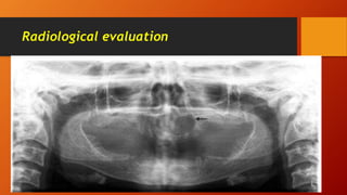 Radiological evaluation
 