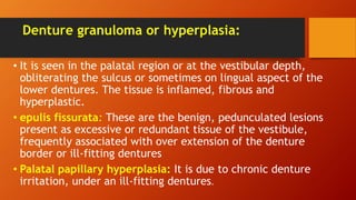 Denture granuloma or hyperplasia:
• It is seen in the palatal region or at the vestibular depth,
obliterating the sulcus or sometimes on lingual aspect of the
lower dentures. The tissue is inflamed, fibrous and
hyperplastic.
• epulis fissurata: These are the benign, pedunculated lesions
present as excessive or redundant tissue of the vestibule,
frequently associated with over extension of the denture
border or ill-fitting dentures
• Palatal papillary hyperplasia: It is due to chronic denture
irritation, under an ill-fitting dentures.
 