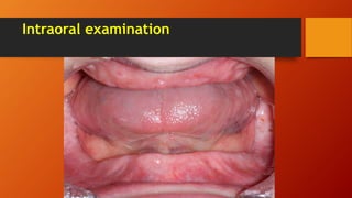 Intraoral examination
 