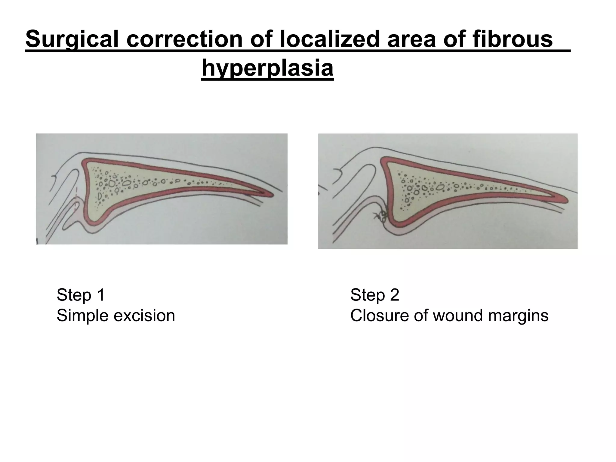 Preprosthetic surgery.pdf