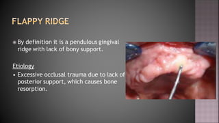 PREPROSTHETIC SURGERY.pdf