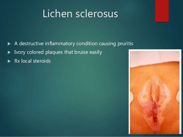 Prepubertal bleeding