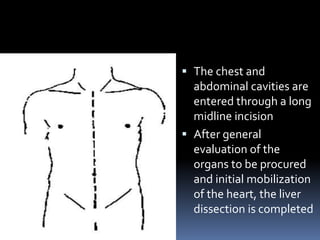  The chest and
abdominal cavities are
entered through a long
midline incision
 After general
evaluation of the
organs to be procured
and initial mobilization
of the heart, the liver
dissection is completed
 