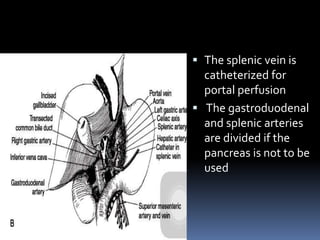 The splenic vein is
catheterized for
portal perfusion
 The gastroduodenal
and splenic arteries
are divided if the
pancreas is not to be
used
 