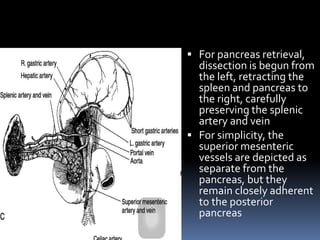  For pancreas retrieval,
dissection is begun from
the left, retracting the
spleen and pancreas to
the right, carefully
preserving the splenic
artery and vein
 For simplicity, the
superior mesenteric
vessels are depicted as
separate from the
pancreas, but they
remain closely adherent
to the posterior
pancreas
 