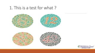 1. This is a test for what ? 
 