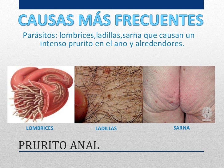 Las lamblias el tratamiento las revocaciones sobre los medios públicos