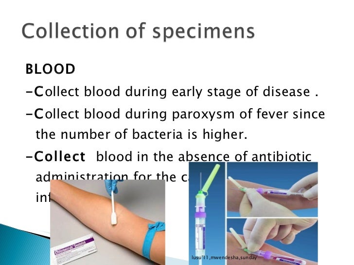 specimen collection&handling,Lusubilo2012