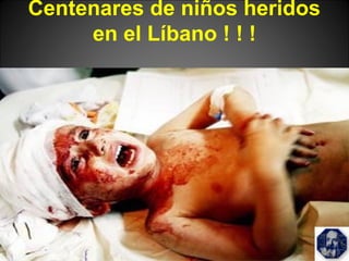 Centenares de niños heridos
en el Líbano ! ! !
 