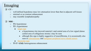 Imaging
 CT –
o well-defined hypodense mass low attenuation lower than that in adjacent soft tissues
o minimal or no contrast enhancement
o may resemble lymphadenopathy
 MRI –
o T1: hypointense
o T2 : hyperintense
■ target sign
● a hyperintense rim (myxoid material ) and central area of a low signal (dense
central area of collagenous stroma ) may be seen
● although this sign is highly suggestive of neurofibroma, it is occasionally also
seen in schwannomas and malignant peripheral nerve sheath tumors
■ fascicular sign
o T1 C+ (Gd): heterogeneous enhancement
 