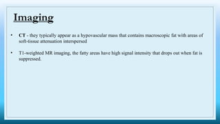 • CT - they typically appear as a hypovascular mass that contains macroscopic fat with areas of
soft-tissue attenuation interspersed
• T1-weighted MR imaging, the fatty areas have high signal intensity that drops out when fat is
suppressed.
Imaging
 