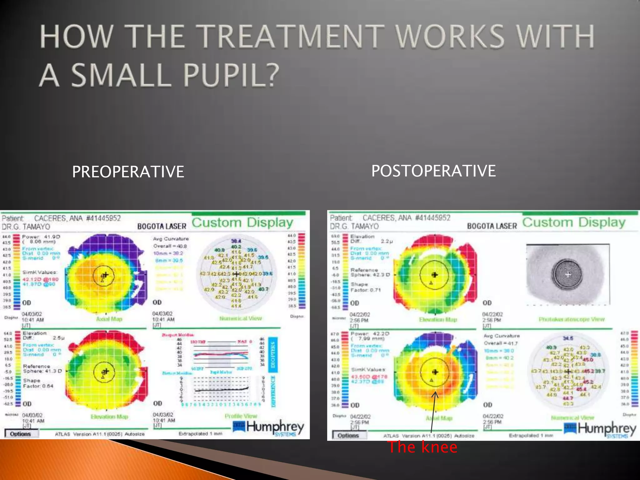 PREOPERATIVE

POSTOPERATIVE

The knee

 