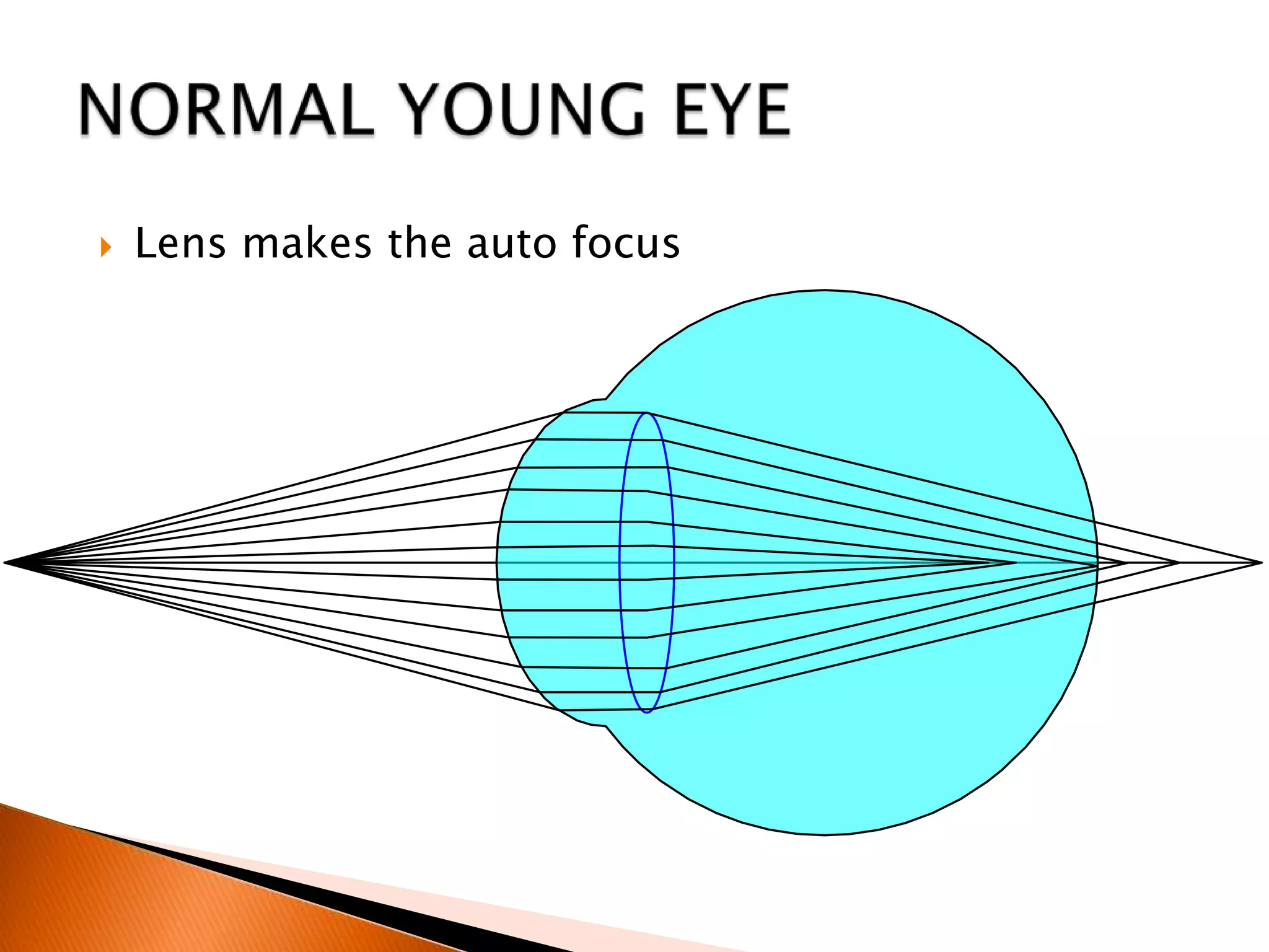 

Lens makes the auto focus

 