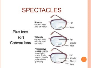 SPECTACLES
Plus lens
(or)
Convex lens
 