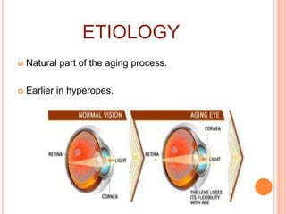 ETIOLOGY
 Natural part of the aging process.
 Earlier in hyperopes.
 