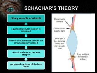 SCHACHAR’S THEORY 
ciliary muscle contracts 
equatorial zonular tension is 
increased 
anterior and posterior zonules are 
simultaneously relaxed 
central surfaces of the lens 
steepen 
peripheral surfaces of the lens 
flatten 
 