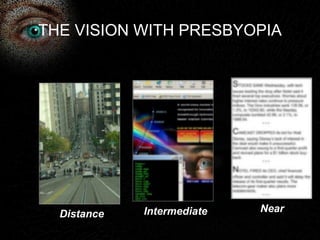 THE VISION WITH PRESBYOPIA 
Distance Intermediate Near 
 