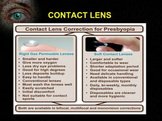 CONTACT LENS 
 