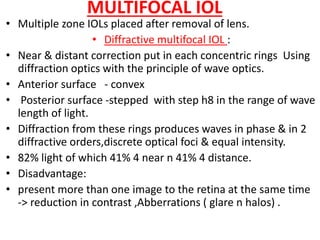 Multifocal Power Rings Presbyopia | PPTX