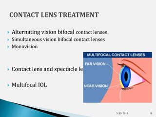  Alternating vision bifocal contact lenses
 Simultaneous vision bifocal contact lenses
 Monovision
 Contact lens and spectacle lenses.
 Multifocal IOL
5/29/2017 19
 