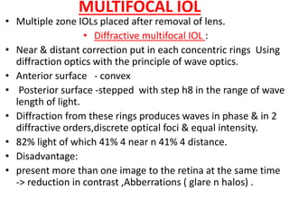 Profil Iol Diffractive Presbyopia | PPTX