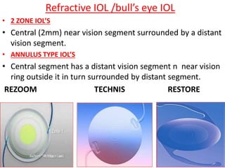Presbyopia | PPTX