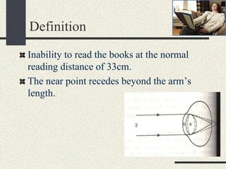 Definition
Inability to read the books at the normal
reading distance of 33cm.
The near point recedes beyond the arm’s
length.
 
