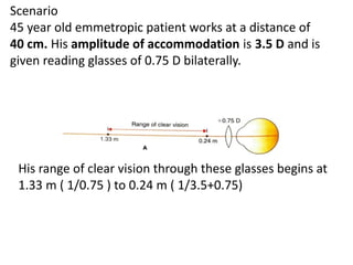 Scenario
45 year old emmetropic patient works at a distance of
40 cm. His amplitude of accommodation is 3.5 D and is
given reading glasses of 0.75 D bilaterally.
His range of clear vision through these glasses begins at
1.33 m ( 1/0.75 ) to 0.24 m ( 1/3.5+0.75)
 