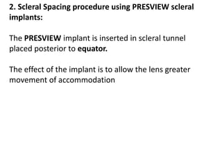2. Scleral Spacing procedure using PRESVIEW scleral
implants:
The PRESVIEW implant is inserted in scleral tunnel
placed posterior to equator.
The effect of the implant is to allow the lens greater
movement of accommodation
 