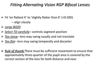 Presbyopic contact lens description | PDF