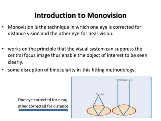 Presbyopic contact lens description | PDF