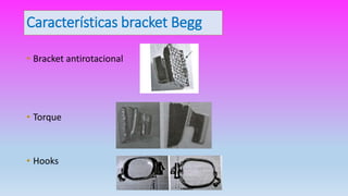 Características bracket Begg
• Bracket antirotacional
• Torque
• Hooks
 