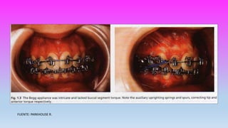 FUENTE: PARKHOUSE R.
 