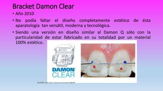 Bracket Damon Clear
• Año 2010
• No podía faltar el diseño completamente estético de ésta
aparatología tan versátil, moderna y tecnológica.
• Siendo una versión en diseño similar al Damon Q sólo con la
particularidad de estar fabricado en su totalidad por un material
100% estético.
 