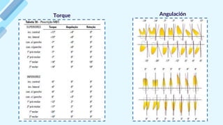 Torque Angulación
 