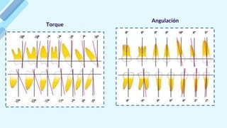 Torque
Angulación
 
