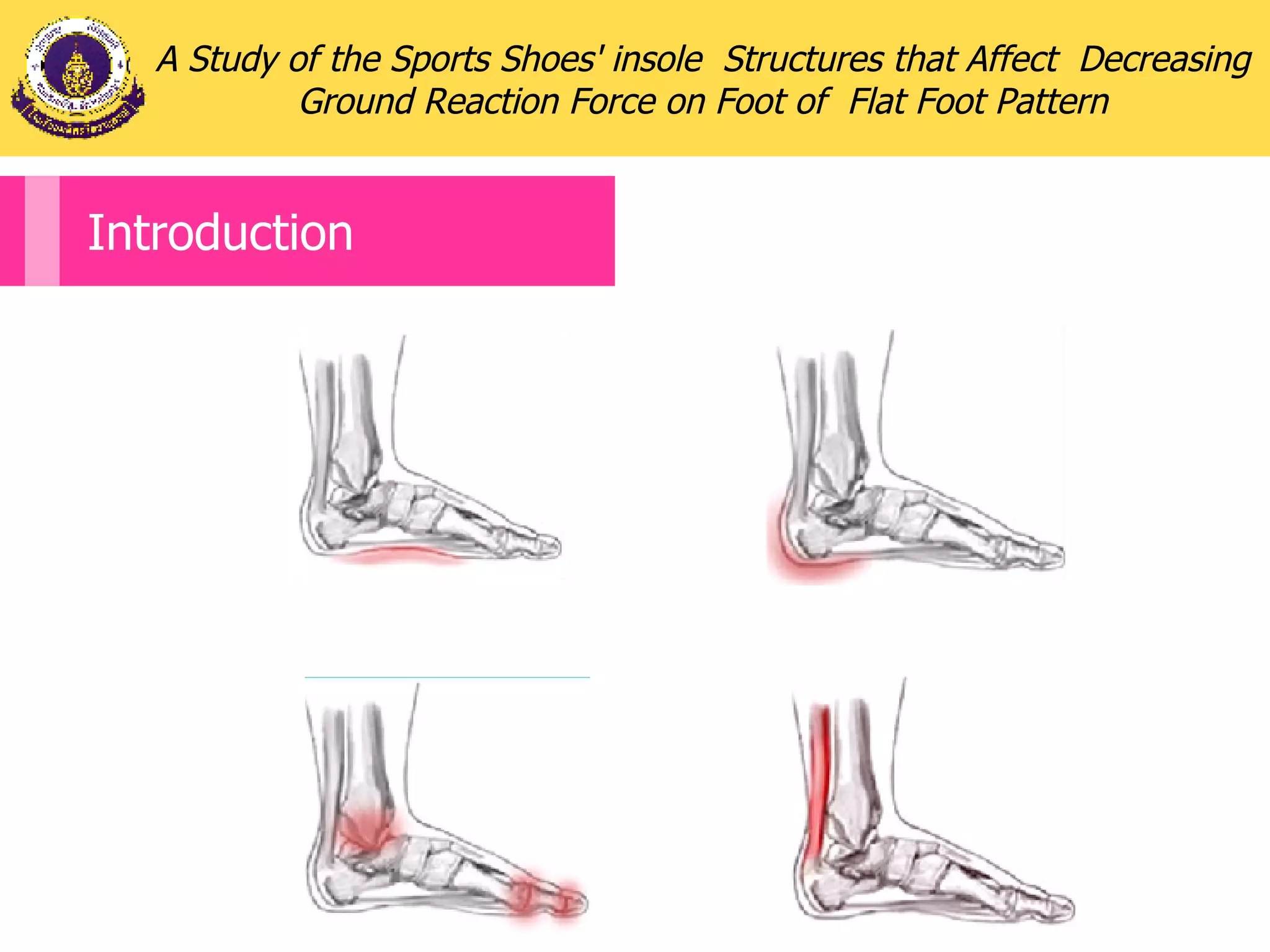 A Study of the Sports Shoes' insole  Structures that Affect  Decreasing Ground Reaction Force on Foot of  Flat Foot Pattern Introduction 