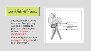 SECONDARY
AORTOENTERIC FISTULA
• Secondary AEF is more
common than primary
AEF and is related to
prior vascular surgery,
with an incidence of
0.36% to 1.6%
• Onset of symptoms is on
average 2 to 6 years after
graft placement.
 