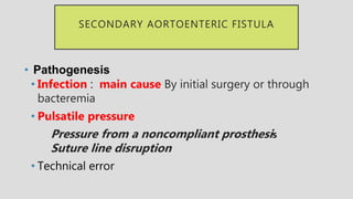 SECONDARY AORTOENTERIC FISTULA
• Pathogenesis
• Infection : main cause By initial surgery or through
bacteremia
• Pulsatile pressure
Pressure from a noncompliant prosthesis
Suture line disruption
• Technical error
 