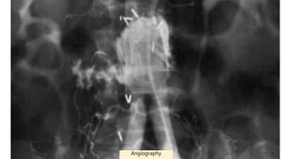 Angiography
 