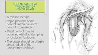 URGENT SURGICAL
TREATMENT OF
HEMORRHAGE
• A midline incision,
• Rapid proximal aortic
control. Infrarenal aorta
control is preferable
• Distal control may be
obtained with iliac clamping
or occlusion balloons.
• The bowel should be sharply
dissected off of the
aneurysm/prosthesis.
 