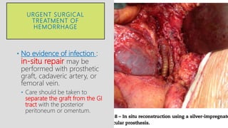 URGENT SURGICAL
TREATMENT OF
HEMORRHAGE
• No evidence of infection :
in-situ repair may be
performed with prosthetic
graft, cadaveric artery, or
femoral vein.
• Care should be taken to
separate the graft from the GI
tract with the posterior
peritoneum or omentum.
 