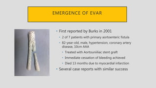 EMERGENCE OF EVAR
• First reported by Burks in 2001
• 2 of 7 patients with primary aortoenteric fistula
• 82-year-old, male, hypertension, coronary artery
disease, 10cm AAA
• Treated with Aortouniiliac stent graft
• Immediate cessation of bleeding achieved
• Died 13 months due to myocardial infarction
• Several case reports with similar success
 