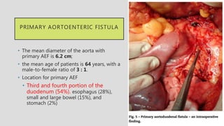 PRIMARY AORTOENTERIC FISTULA
• The mean diameter of the aorta with
primary AEF is 6.2 cm;
• the mean age of patients is 64 years, with a
male-to-female ratio of 3 : 1.
• Location for primary AEF
• Third and fourth portion of the
duodenum (54%). esophagus (28%),
small and large bowel (15%), and
stomach (2%)
 